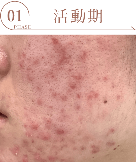 活動期