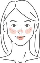 毛穴のイラスト