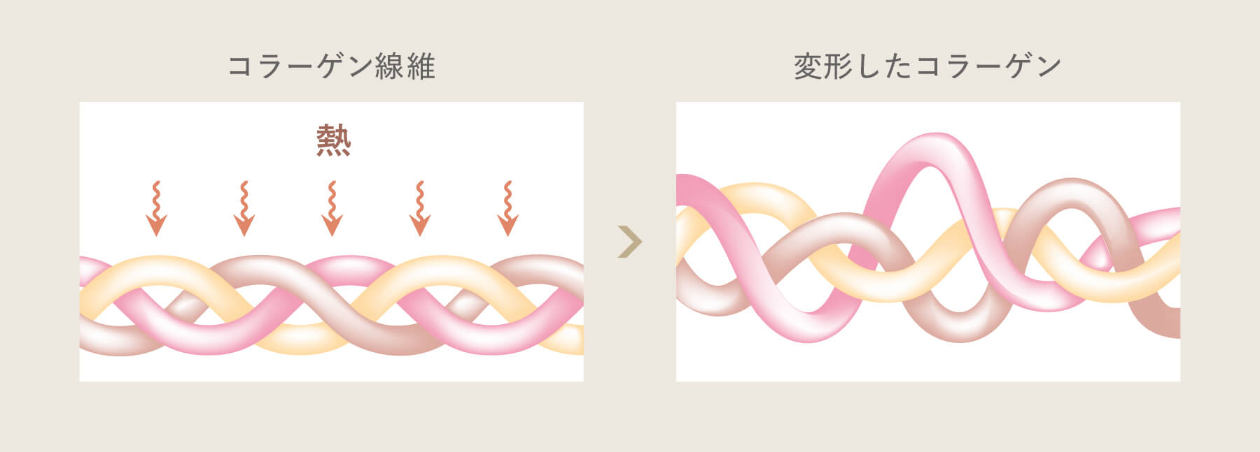 引き締め理論のイメージイラスト