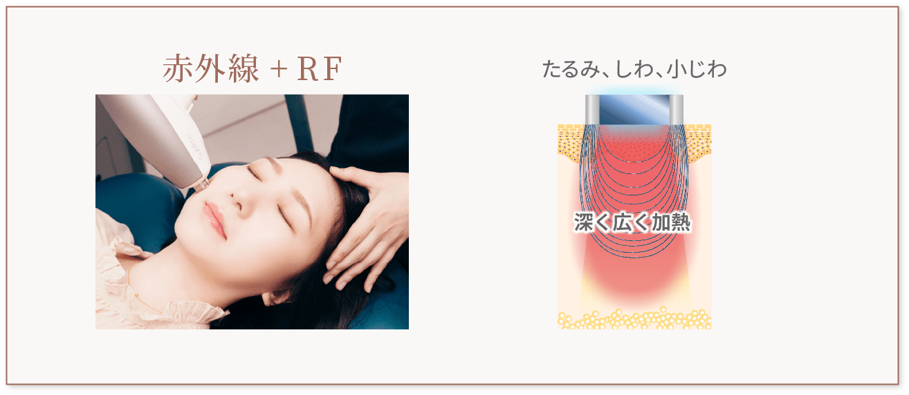 赤外線+RF